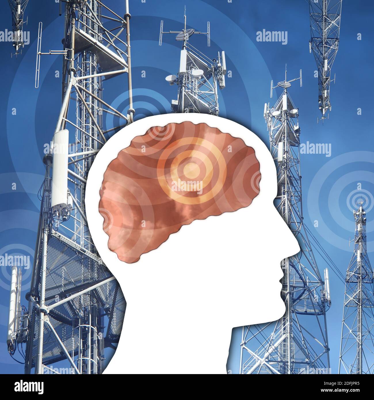 5G antennes et ondes électriques autour et à l'intérieur du cerveau humain Profil - Collage Banque D'Images