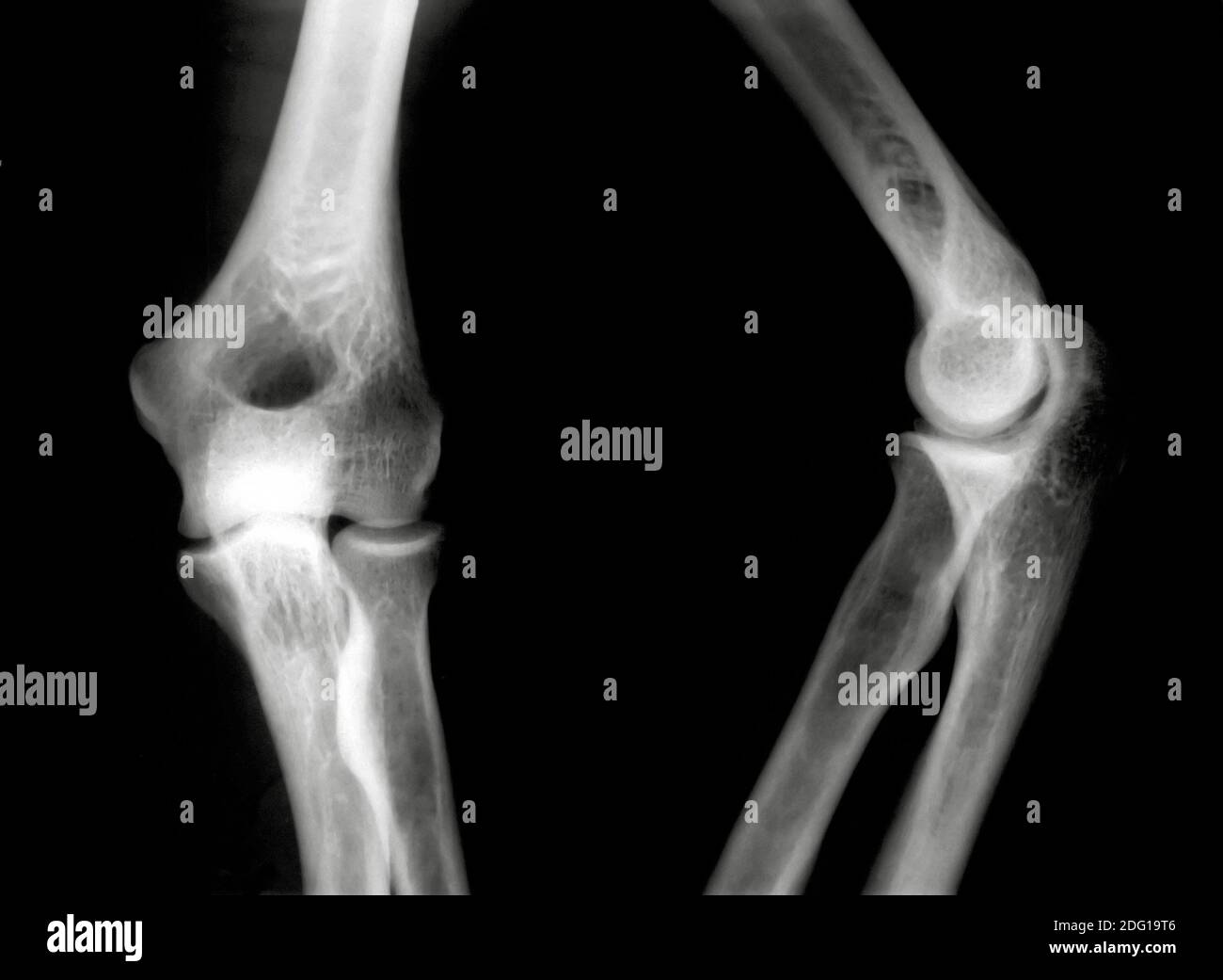 Genoux Banque D'Images