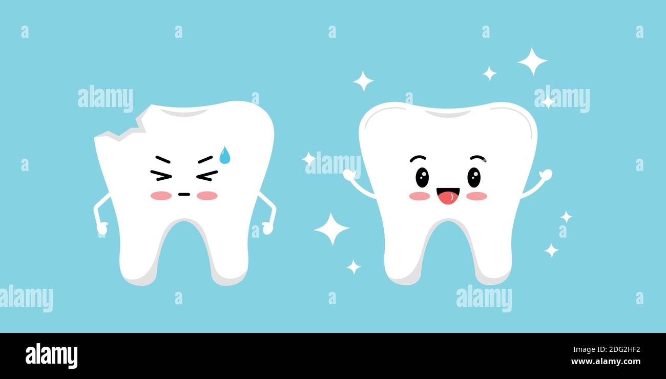 Dent ébréchée et dent saine avant, après l'ensemble d'icônes de traitement. Illustration de Vecteur