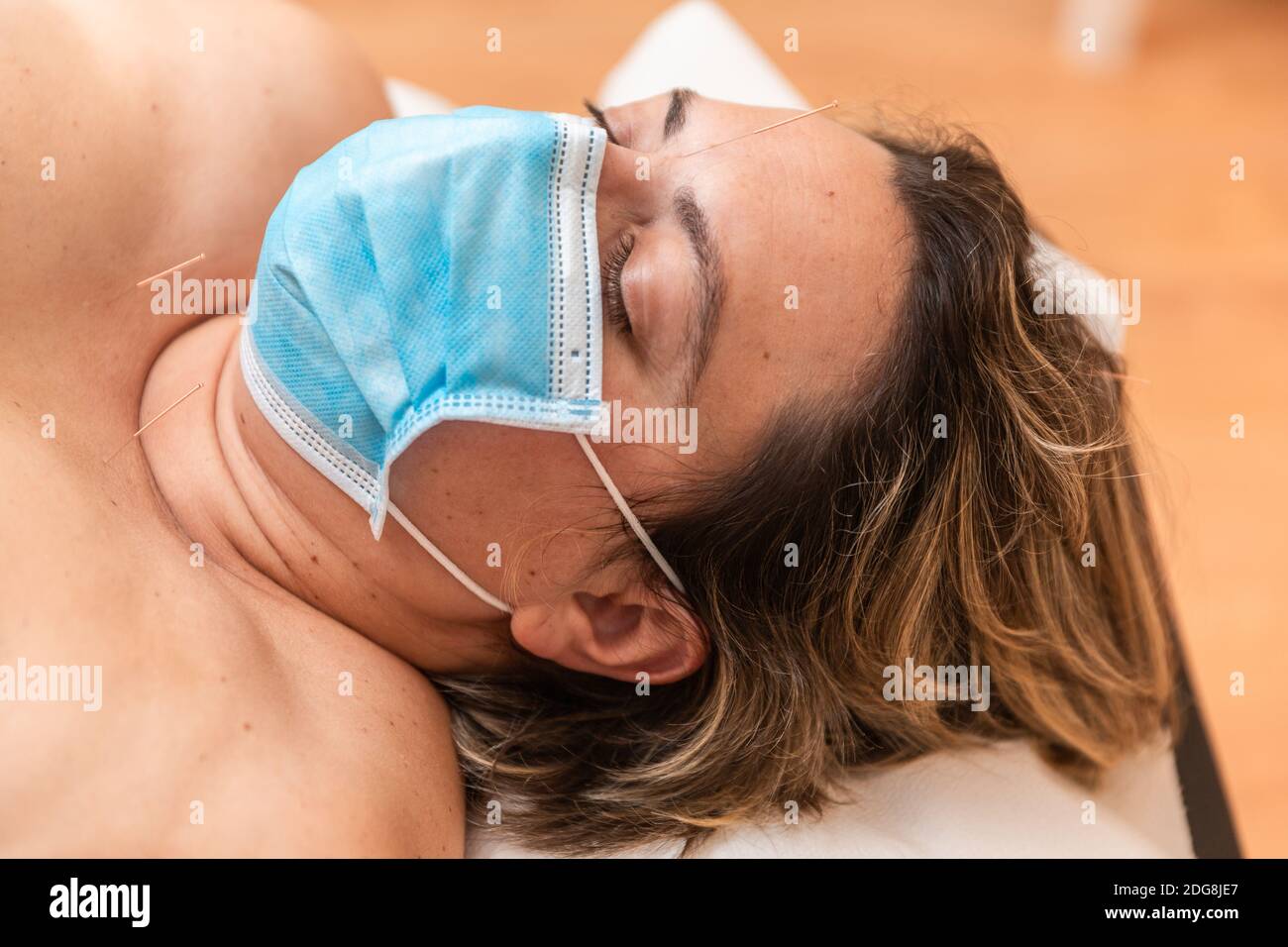 une femme se trouve sur une civière dans la chambre d'un physiothérapeute avec des aiguilles d'acupuncture, portant un masque de protection contre le coronavirus Banque D'Images