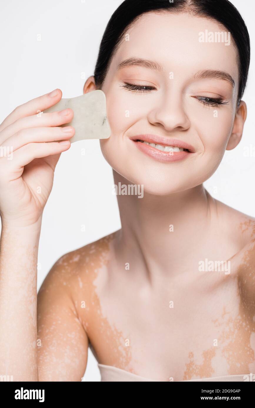 souriant jeune belle femme avec vitiligo utilisant gua sha isolé sur blanc Banque D'Images