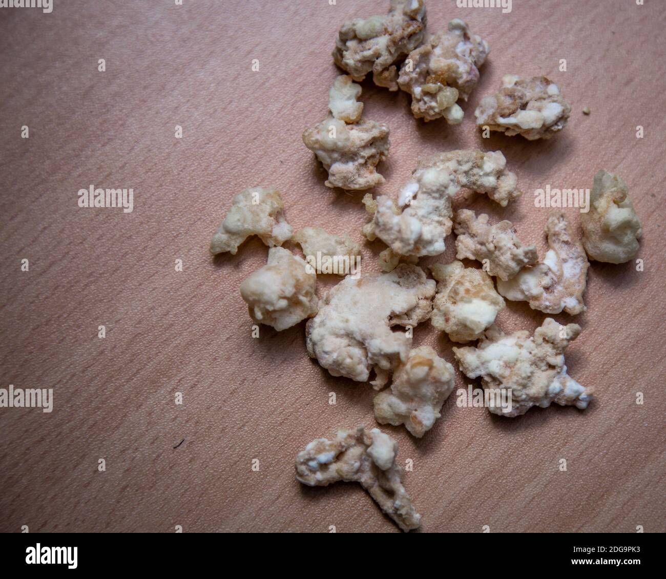 Des rochers de crack de drogue de cocaïne sur le plan d'examen Banque D'Images