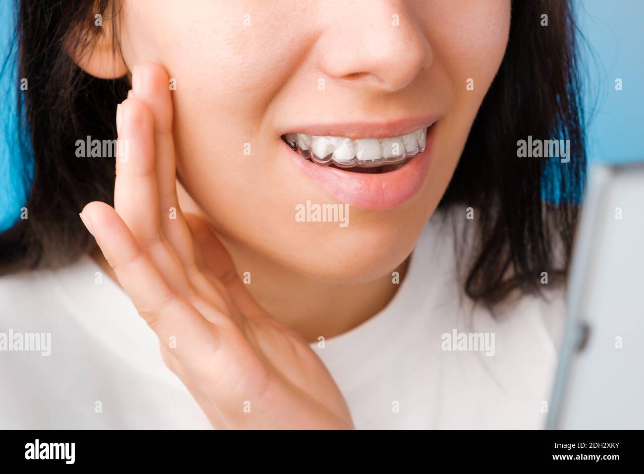 Jeune femme gaie regardant dans le miroir dans des aligneurs transparents pour lisser et blanchir les dents. Bretelles amovibles pour corriger les morsures Banque D'Images