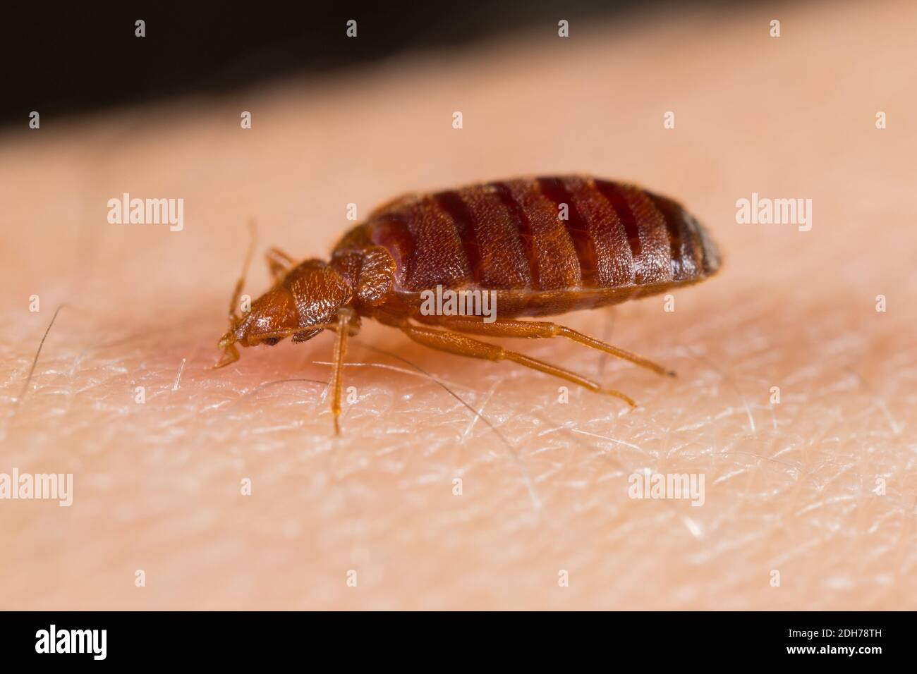 Insecte de lit commun (Cimex lectularius) se nourrissant sur un hôte humain Banque D'Images