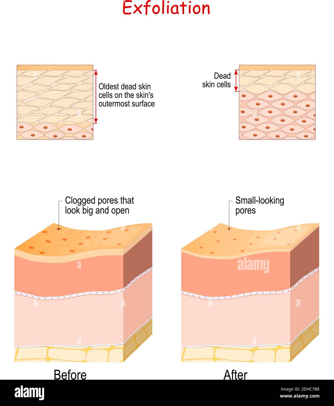 L'exfoliation est l'élimination des anciennes cellules mortes de la peau sur la surface externe de la peau. Coupe transversale des couches de peau avant et après l'exfoliation. Gros plan Illustration de Vecteur