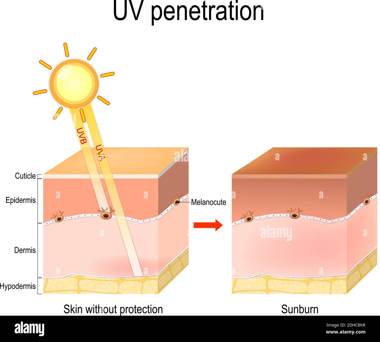 pénétration uv dans les couches de la peau humaine. Les rayons UVB ne pénètrent pas profondément la peau car ils sont bloqués par l'épiderme. Pénétration UVA Illustration de Vecteur