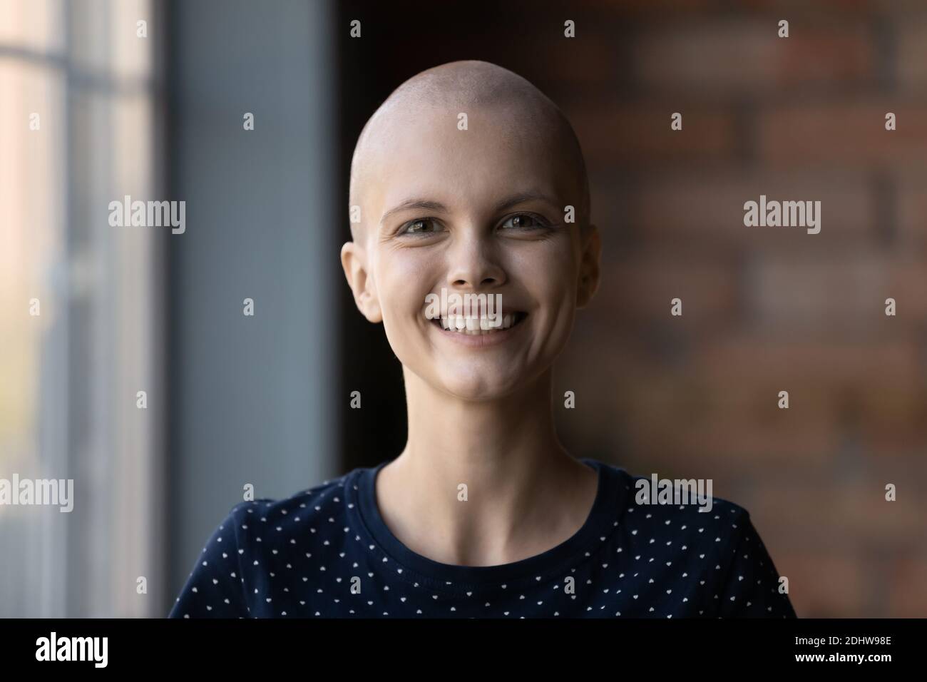 Tête prise de vue portrait sourire femme sans cheveux regardant l'appareil photo Banque D'Images