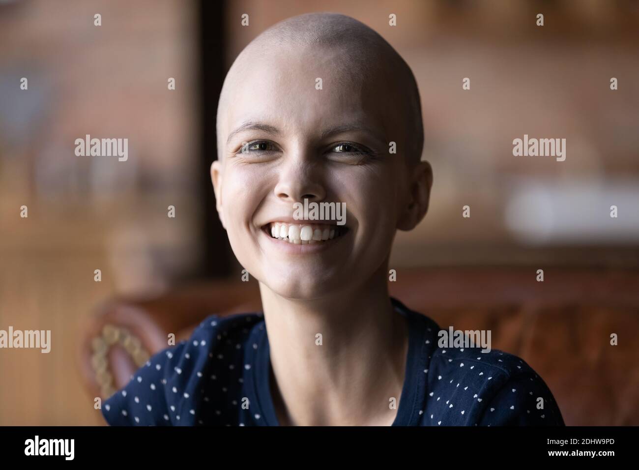 Tête prise de vue portrait sourire sans cheveux malade femme regardant l'appareil photo Banque D'Images