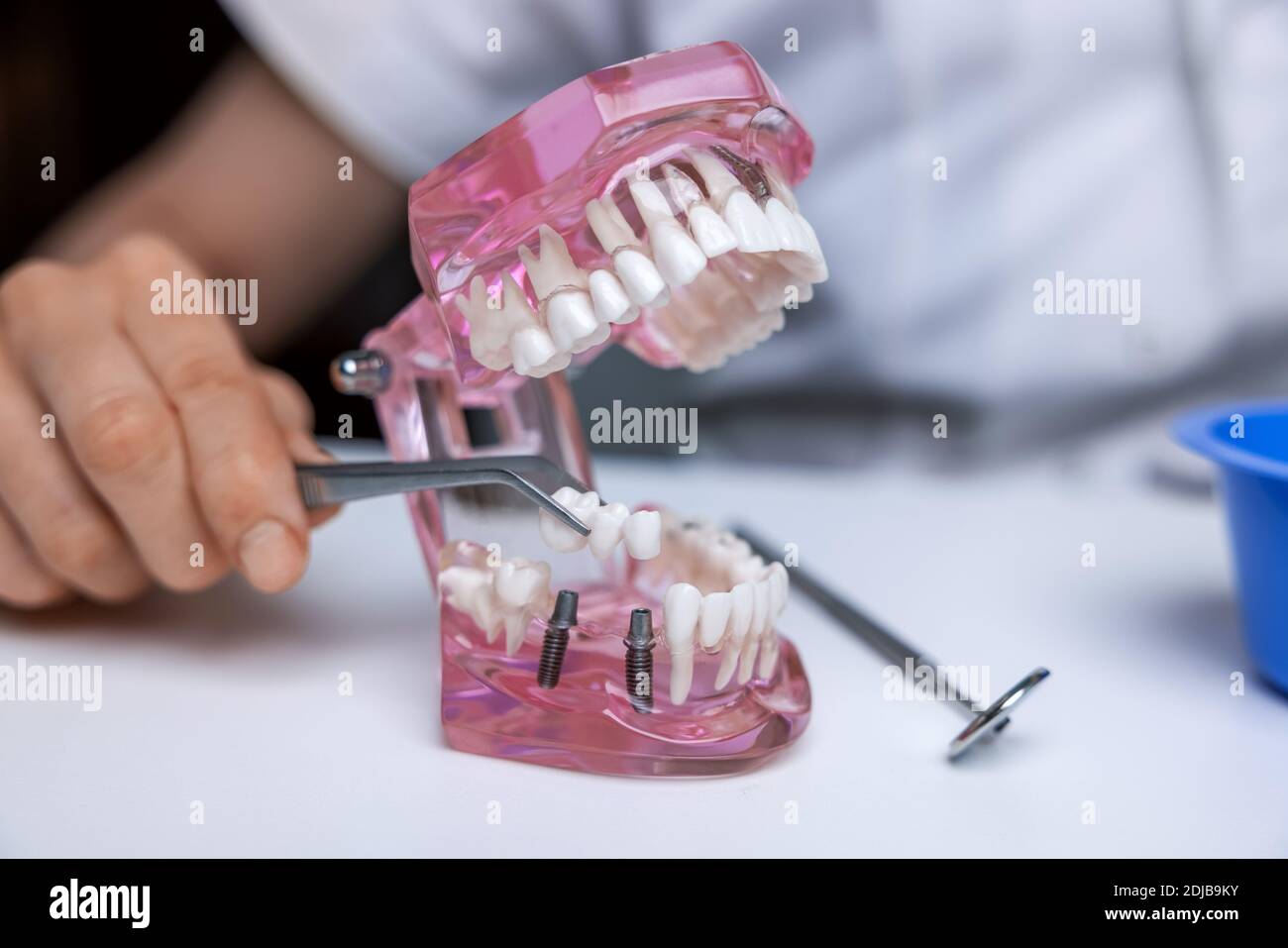 dentiste implantologue montrant la technologie d'implant de pont dentaire sur la dent humaine modèle de mâchoire Banque D'Images