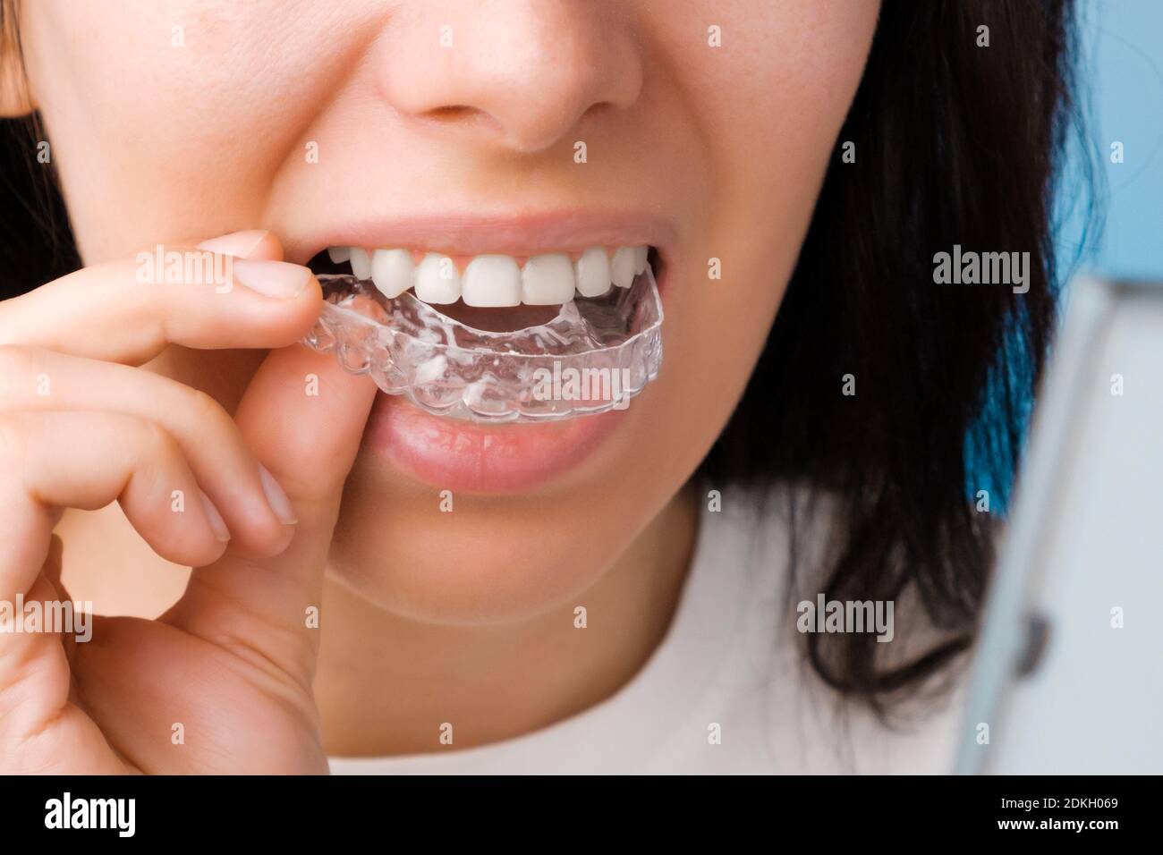 Femme souriante avec des dents parfaites et saines utilisant des bretelles amovibles ou un outil d'alignement pour lisser et blanchir les dents. Traitement orthodontique pour Banque D'Images