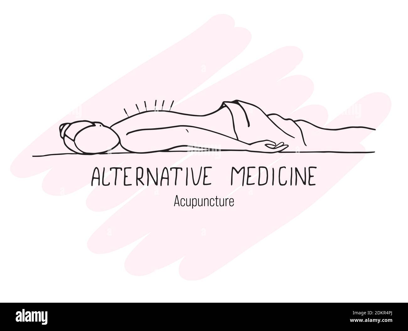 la fille passe par une séance d'acupuncture. Médecine alternative. Doodle Illustration de Vecteur