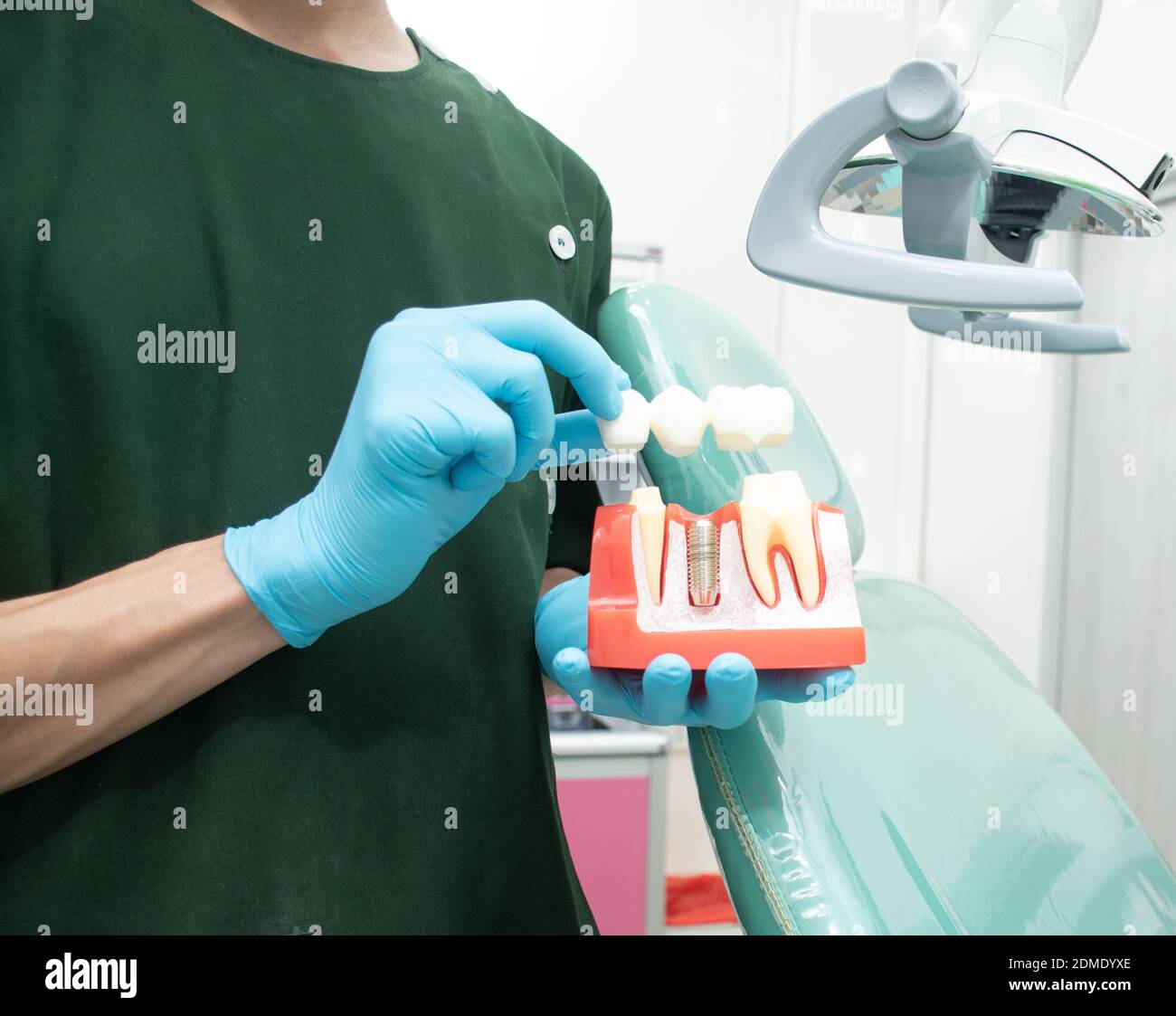 Dentiste masculin en uniforme vert portant un échantillon d'implants  dentaires par rapport aux dents naturelles pour expliquer en détail. Est  une connaissance pour les patients avant le traitement dentaire Photo Stock  -