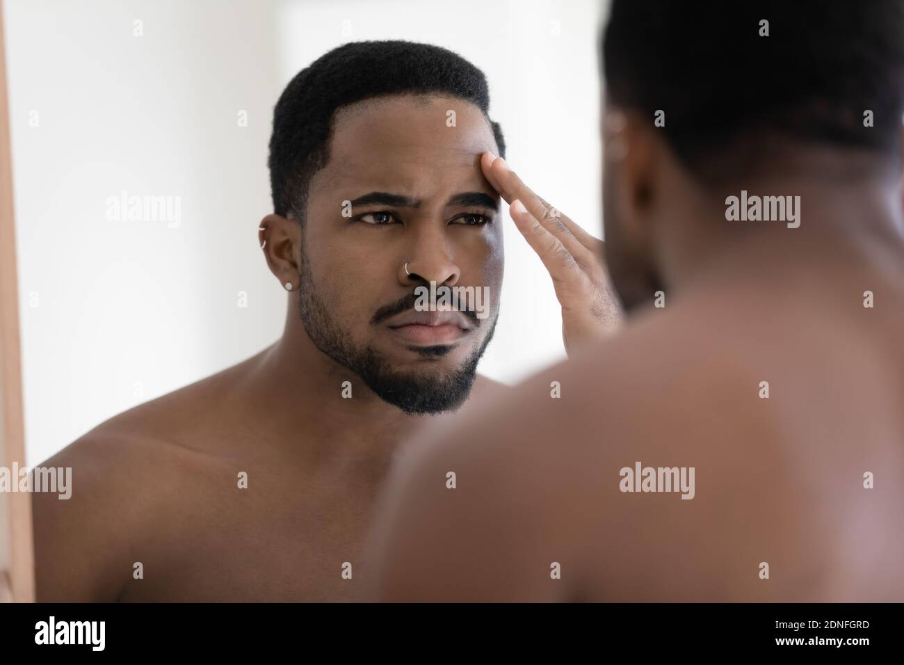 Un jeune homme afro-américain stressé se sent insatisfait de l'état de la peau. Banque D'Images