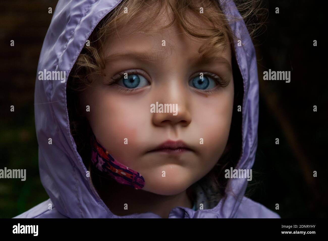 Gros plan portrait d'une fille avec yeux bleus perçants avec un plâtre sur son visage Banque D'Images