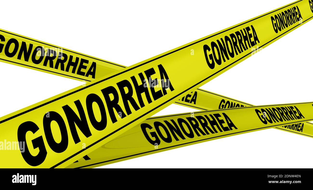 Gonorrhée. Rubans d'avertissement jaunes avec des mots noirs GONORRHÉE (est une infection sexuellement transmise causée par la bactérie Neisseria gonorrhoeae) Banque D'Images