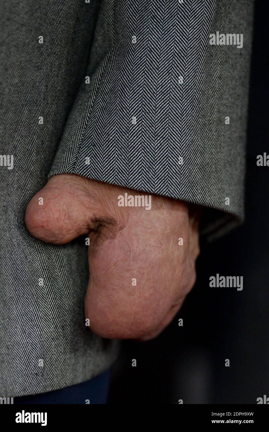 Beck Weathers assiste à la première d'Everest à Los Angeles, CA, USA, le 9 septembre 2015. Photo de Lionel Hahn/ABACAPRESS.COM Banque D'Images