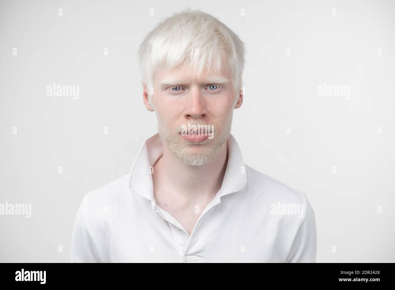 Portrait d'un homme albinos dans studio habillé t-shirt isolé sur un fond blanc. déviations anormales. Aspect insolite anomalie de la peau. Banque D'Images