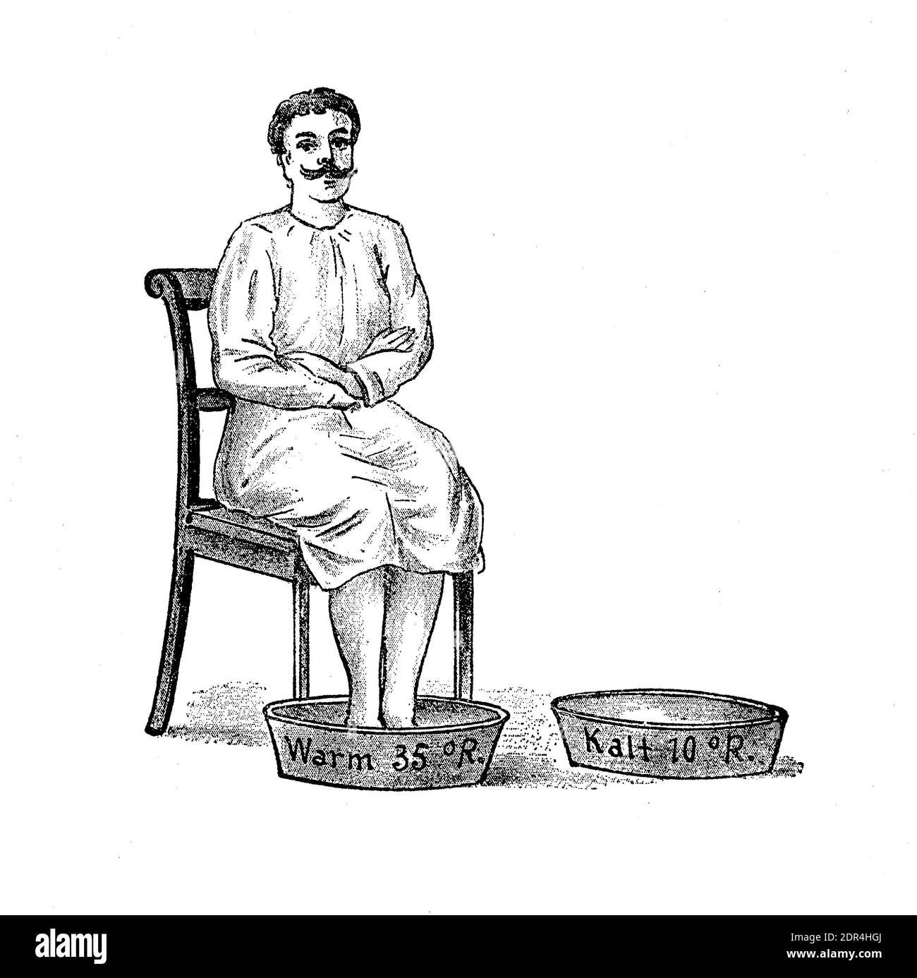 Thérapie de bain de contraste: Homme prenant un bain de pieds alternant l'eau chaude et froide plusieurs fois, illustration du XIXe siècle Banque D'Images