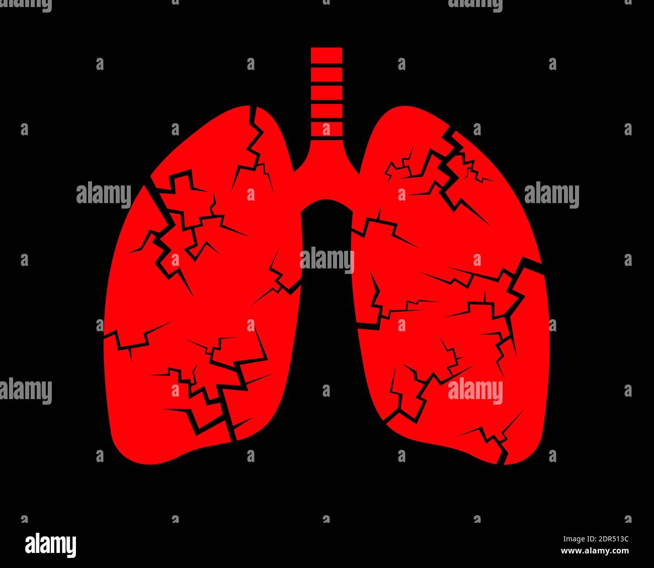 Pneumonie et cancer du poumon - la maladie et la maladie endommagent l'organe interne du corps humain. Problème de santé basé sur l'infection, virus, bactéries, tumeur an Banque D'Images