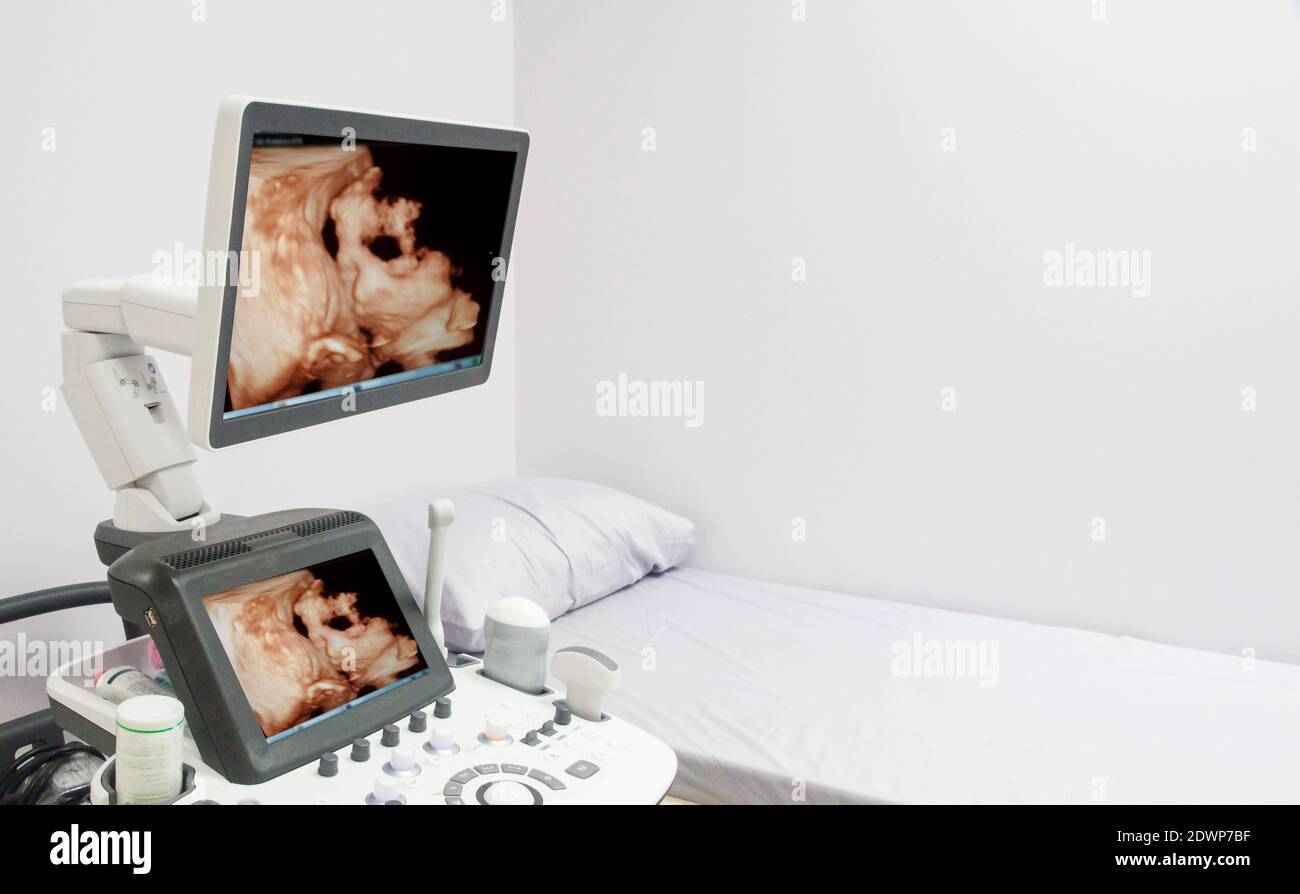 Echographie 3d 4d De Bebe Dans L Uterus De La Mere Afficher Sur Le Moniteur Lcd Dans La Salle Hopital Concept Medical Photo Stock Alamy