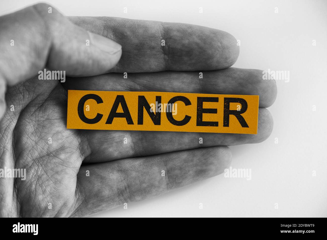 Homme tenant un morceau de papier jaune avec le mot cancer. Gros plan. Banque D'Images Homme tenant un morceau de papier jaune avec le mot cancer. Gros plan. Banque D'Images