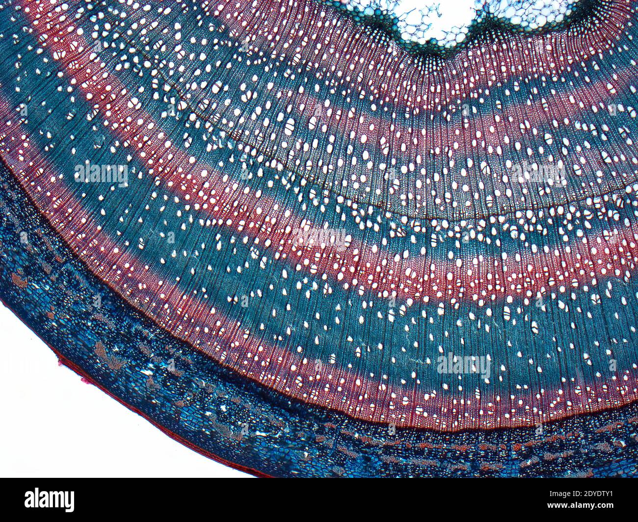 Woody STEM.Light micrographe (LM) d'une coupe transversale à travers une tige ligneuse d'un arbre. Banque D'Images
