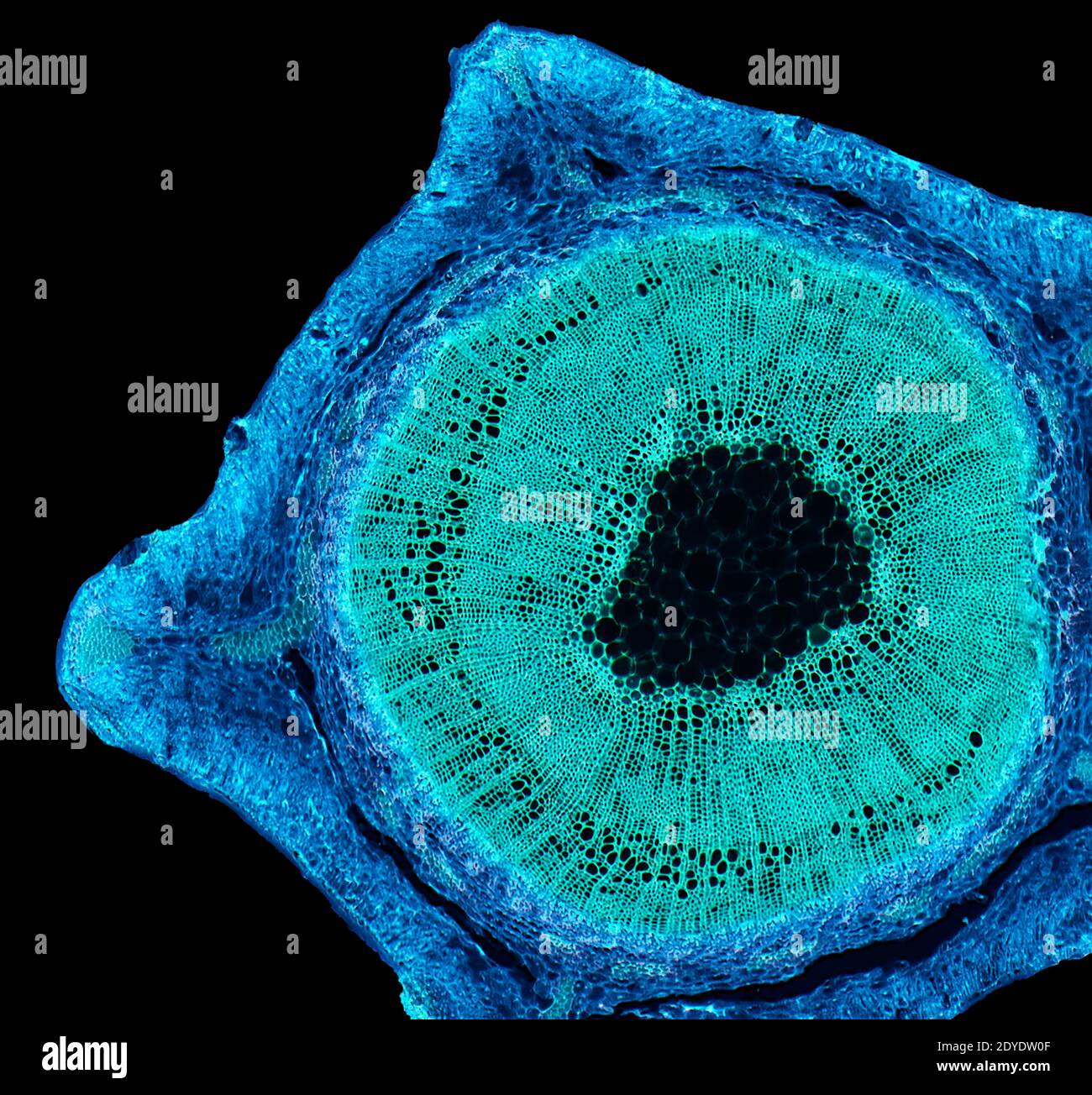 Tige de balai. Micrographe léger (LM) d'une section transversale à travers la tige d'une plante à balai commun (Salicornia europaea). Banque D'Images