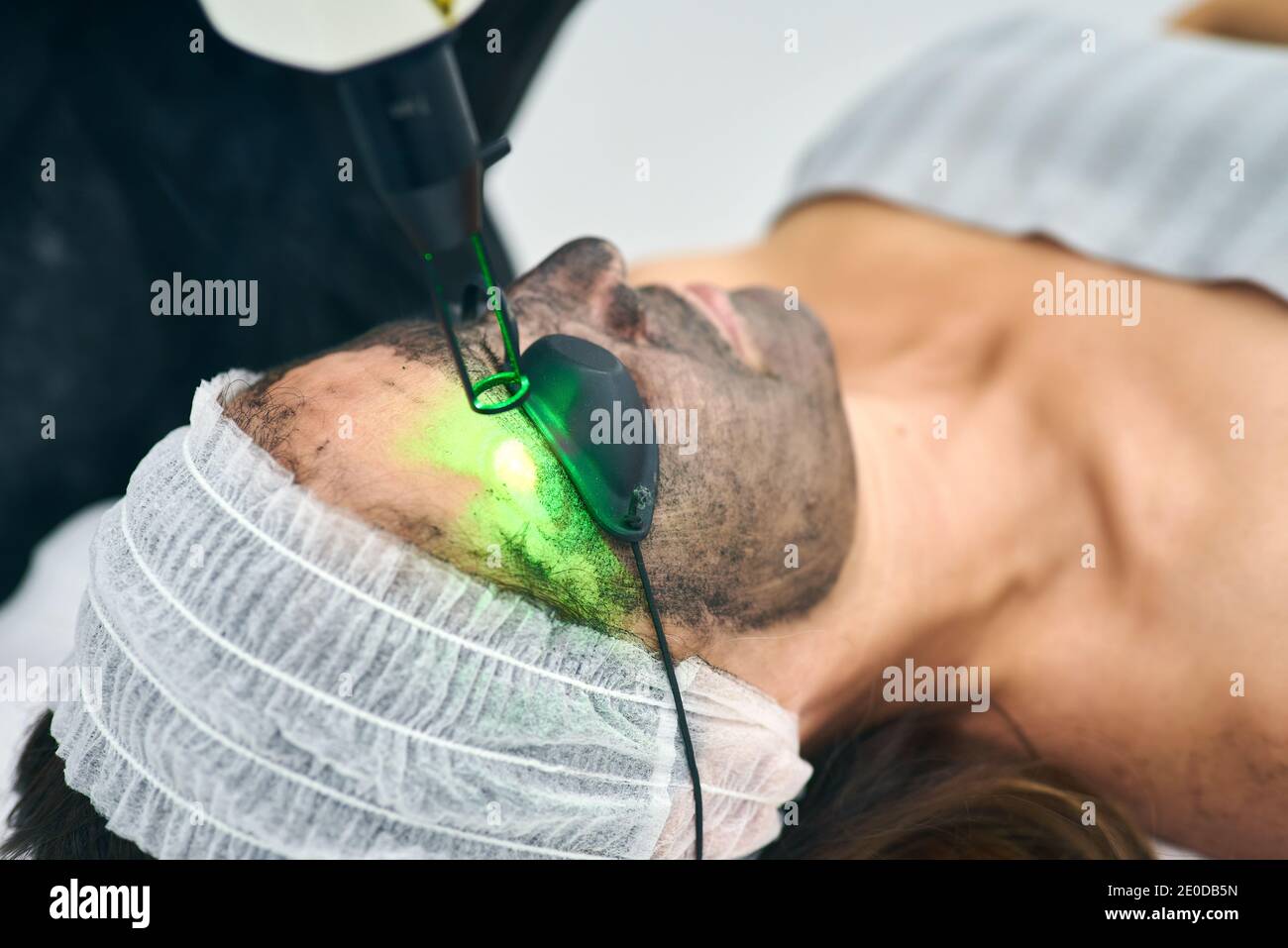 Esthéticienne anonyme utilisant une machine pour l'écorces de carbone sur le visage de cliente couchée dans des lunettes de protection dans une clinique de beauté Banque D'Images