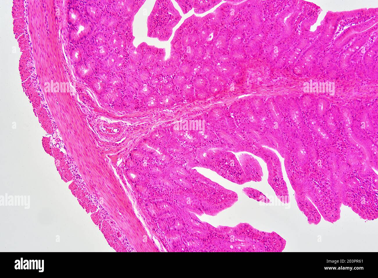 Intestin grêle humain (jéjunum) montrant de gauche à droite : séreuse, fibres musculaires, sous-muqueuse et muqueuse avec cryptes de Lieberkhun. X75 à 10 cm de large. Banque D'Images