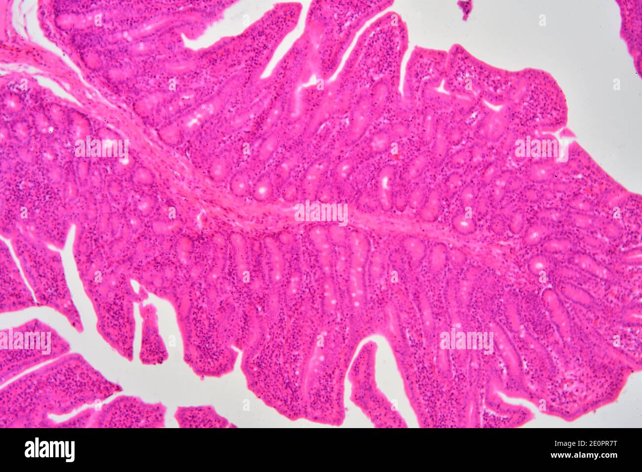 Intestin grêle humain (jéjunum) montrant une muqueuse avec des cryptes de Lieberkhun. X75 à 10 cm de large. Banque D'Images