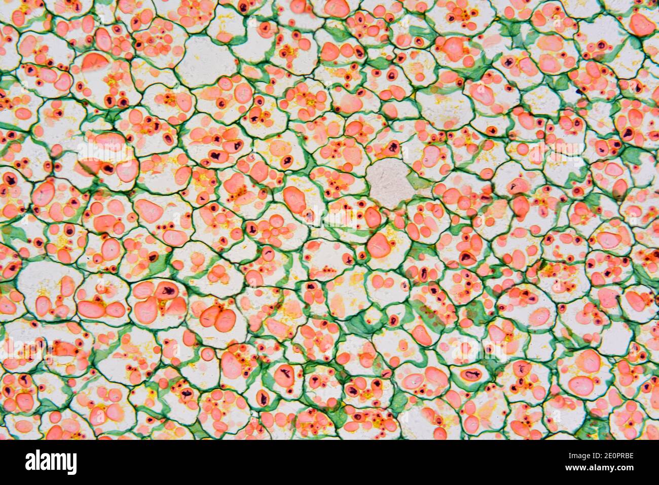 Amyloplaste solanum Banque de photographies et d’images à haute résolution Alamy
