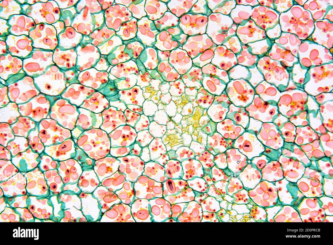 Amyloplaste solanum Banque de photographies et d’images à haute résolution Alamy