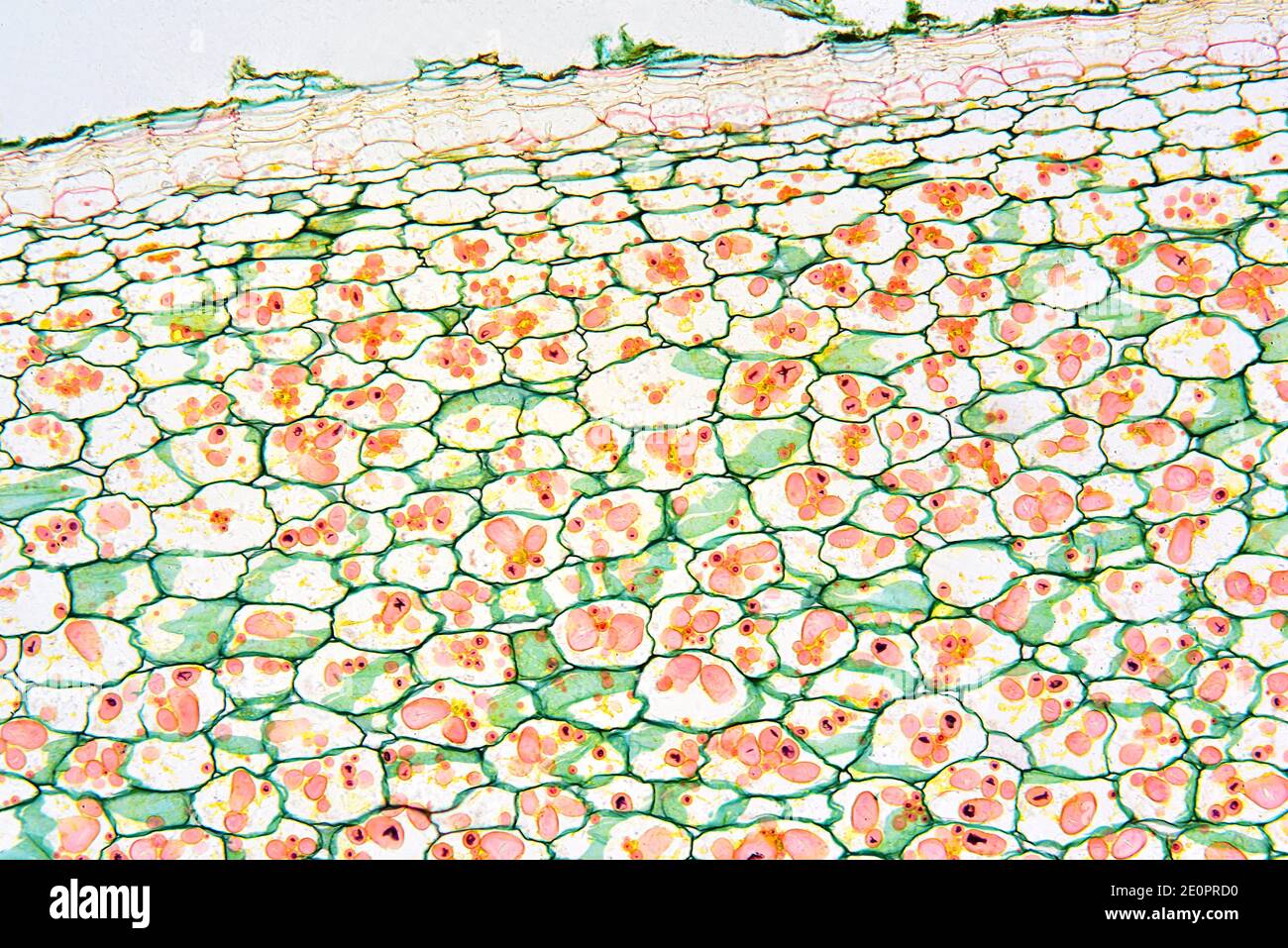 Amyloplaste solanum Banque de photographies et d’images à haute résolution Alamy