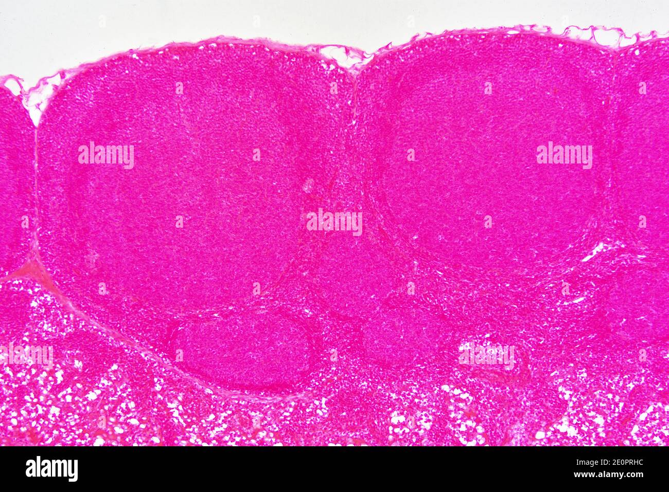 Ganglion lymphatique ou glande lymphatique avec capsule, nodule lymphoïde et trabéculae. Photomicrographe X75 à 10 cm de large. Banque D'Images