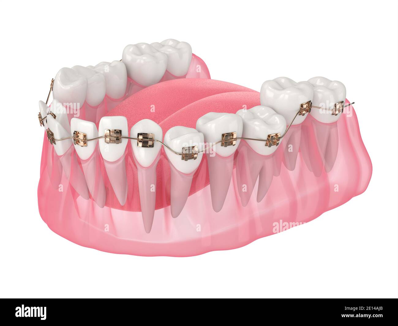 rendu 3d de l'alignement des dents par des accolades orthodontiques sur du blanc arrière-plan Banque D'Images