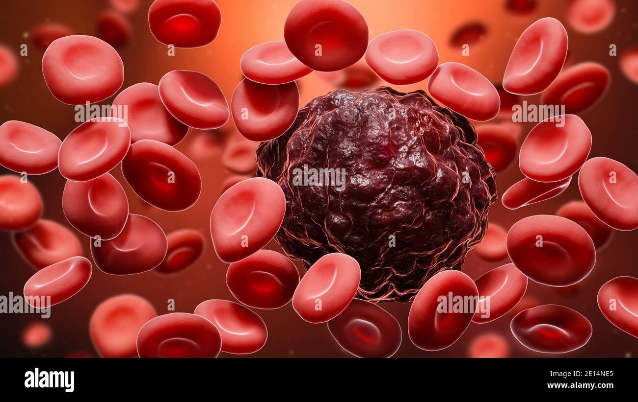 Illustration du rendu 3D des cellules cancéreuses au milieu des globules rouges. Oncologie, cancérologie, métastase, médecine, microbiologie, science, maladie, santé conc Banque D'Images