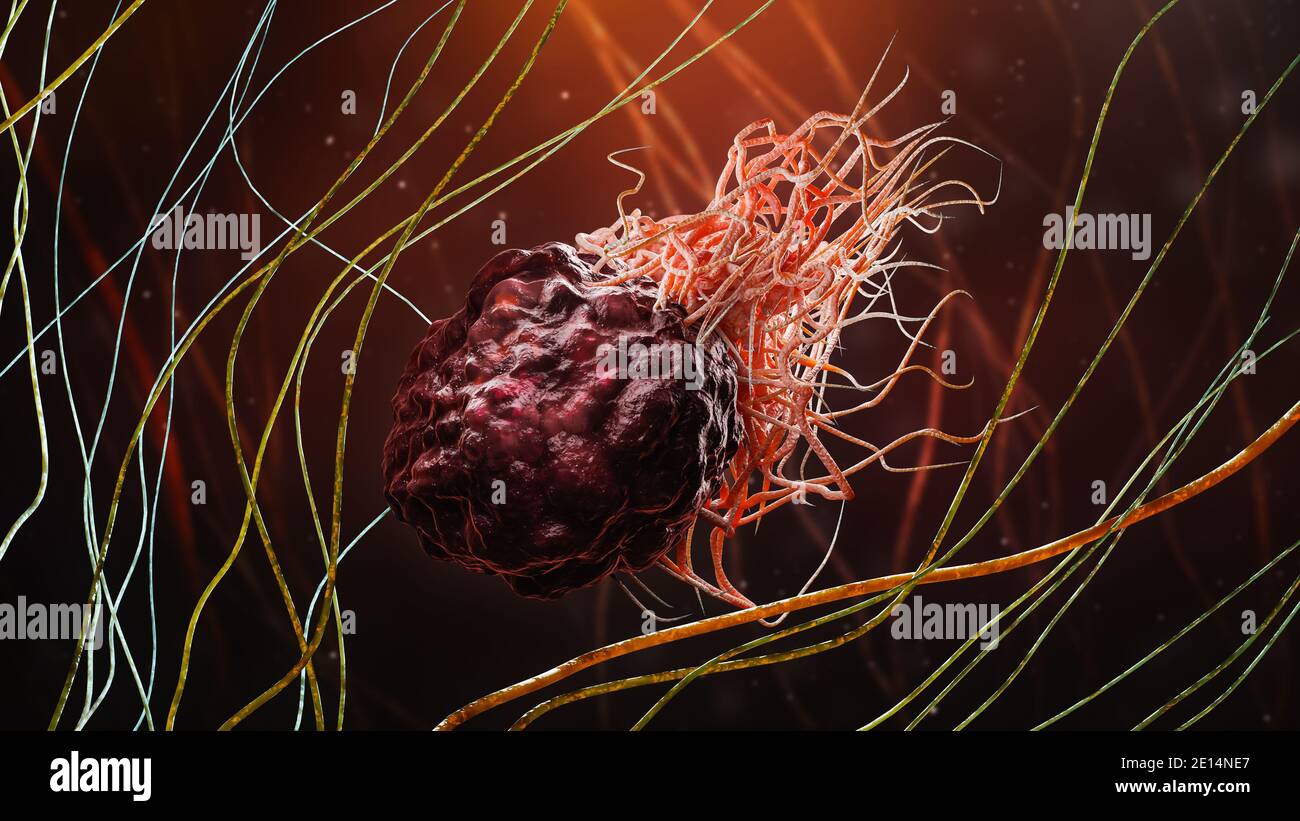 Illustration du rendu 3D en gros plan du cancer ou de la cellule tumorale dans les tissus fibreux. Carcinome, lymphome, oncologie, médecine, science, microbiologie, cancer Banque D'Images