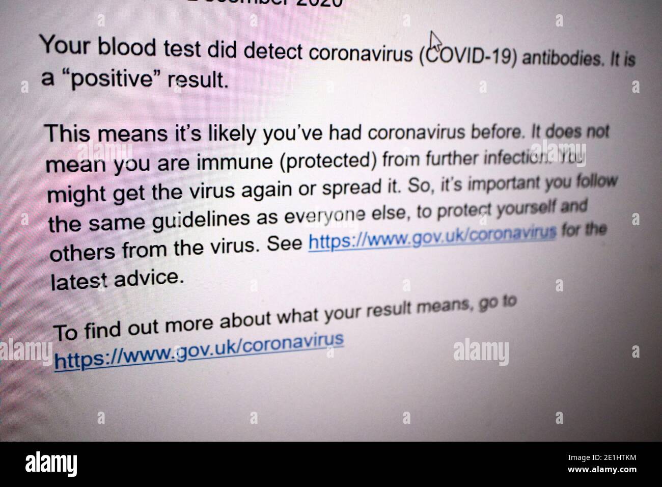 message à l'écran donnant un résultat positif d'un nhs test sanguin d'anticorps covid-19 pour les anticorps du coronavirus reçus dans le royaume-uni Banque D'Images
