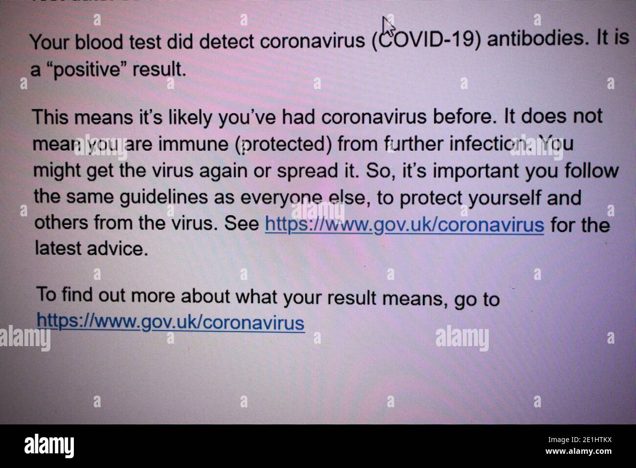 message à l'écran donnant un résultat positif d'un nhs test sanguin d'anticorps covid-19 pour les anticorps du coronavirus reçus dans le royaume-uni Banque D'Images
