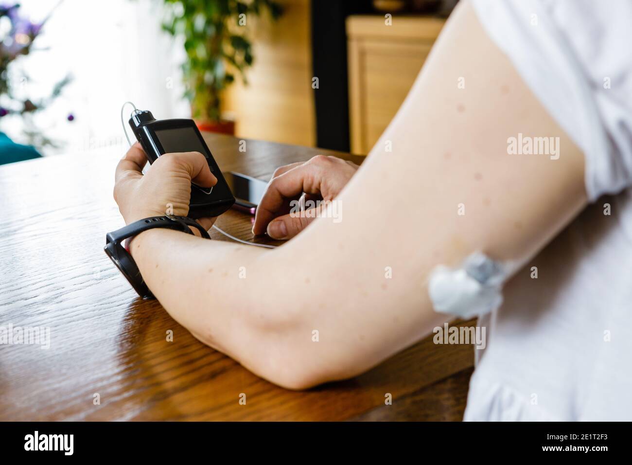 Traitement moderne du diabète, femme vérifiant le niveau de glucose et doser l'insuline à l'aide d'une pompe à insuline et d'un capteur à distance sur sa main, se concentrer sur l'arrière-plan Banque D'Images