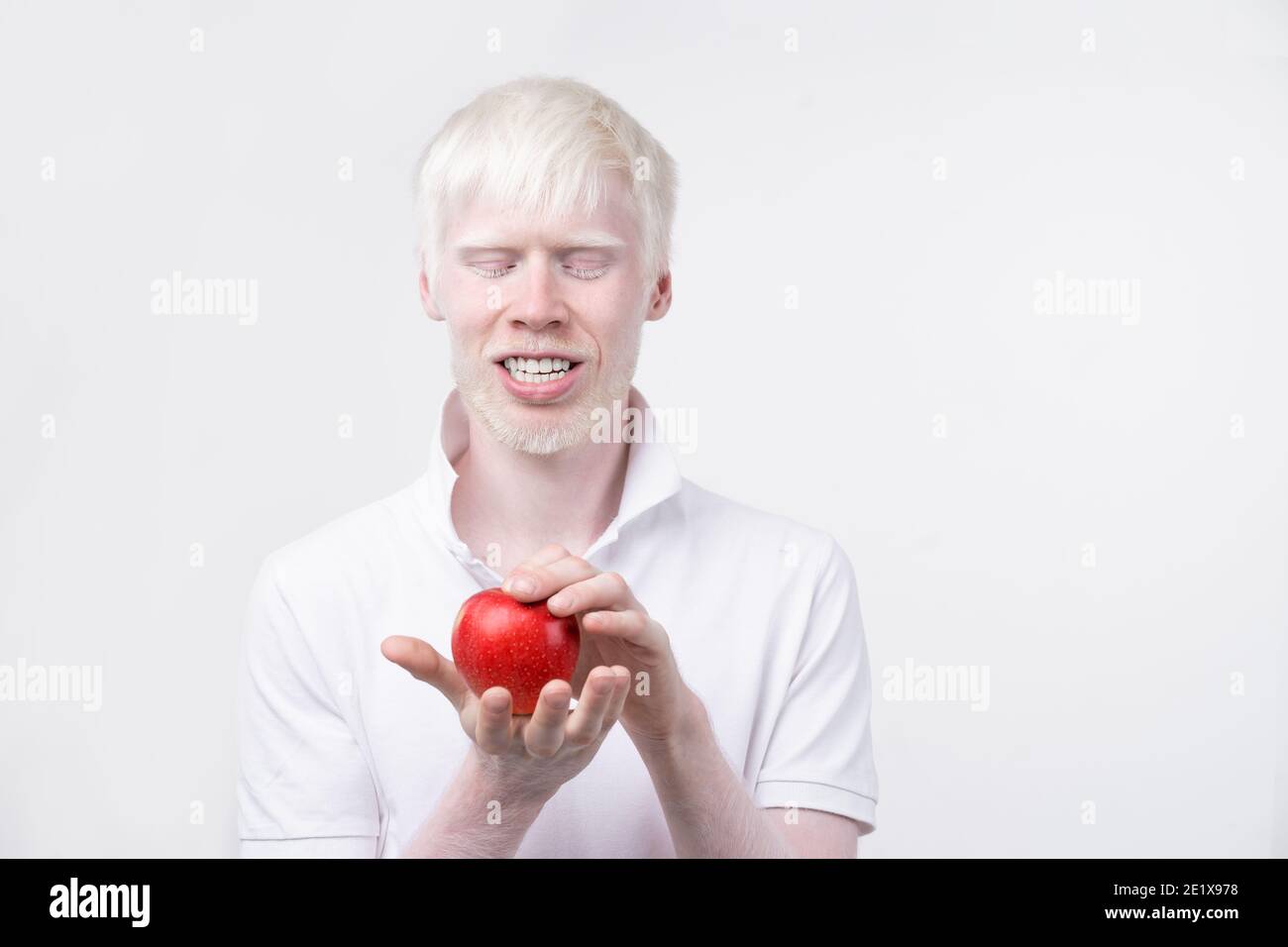 albinisme albinos homme en studio vêtu t-shirt isolé sur fond blanc. déviations anormales. aspect inhabituel. anomalie de la peau Banque D'Images