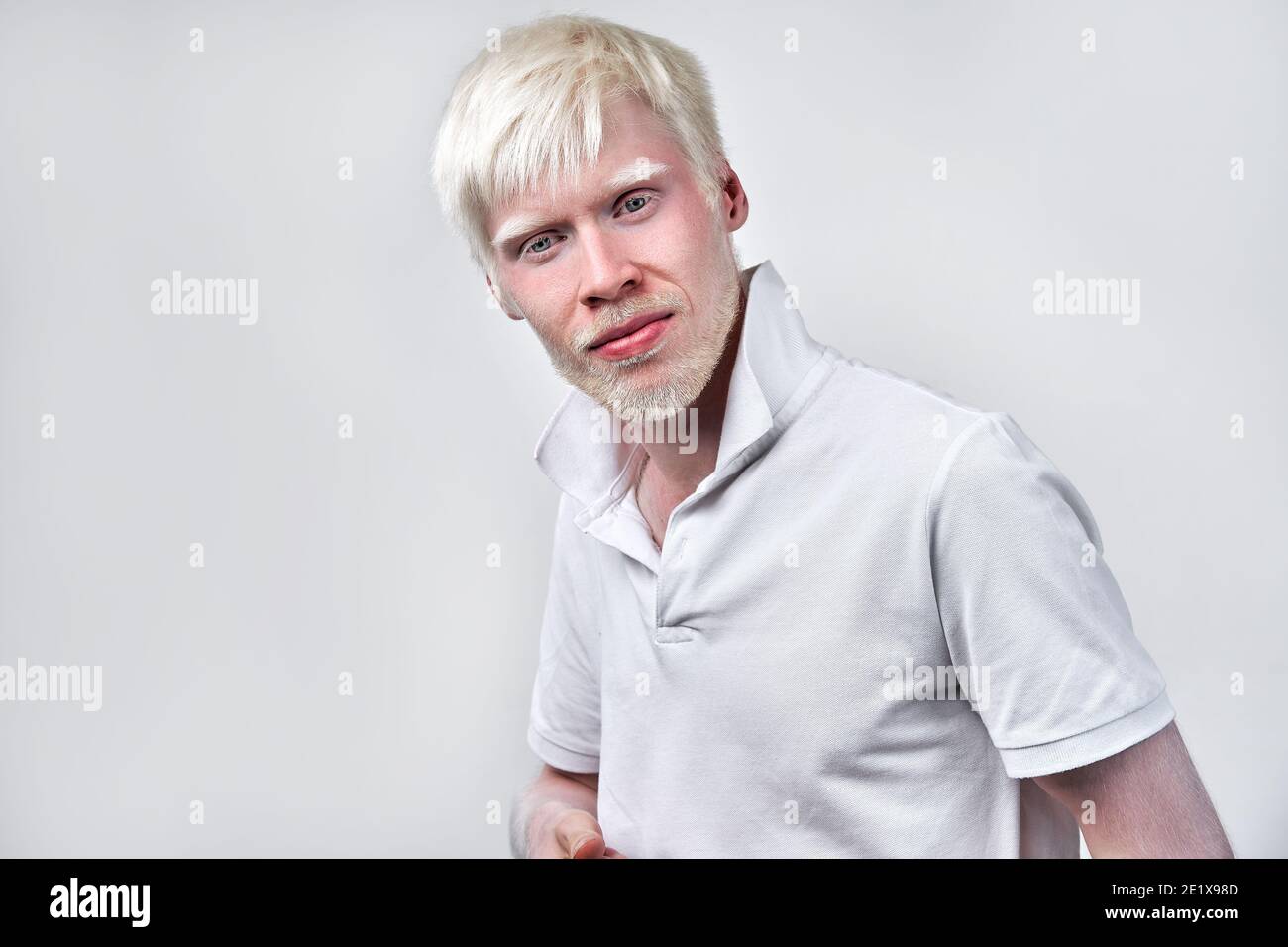 Albinisme albino homme peau blanche cheveux studio habillé t-shirt isolé fond blanc. Anomalies. Aspect inhabituel. Anomalie de la peau Beauti Banque D'Images