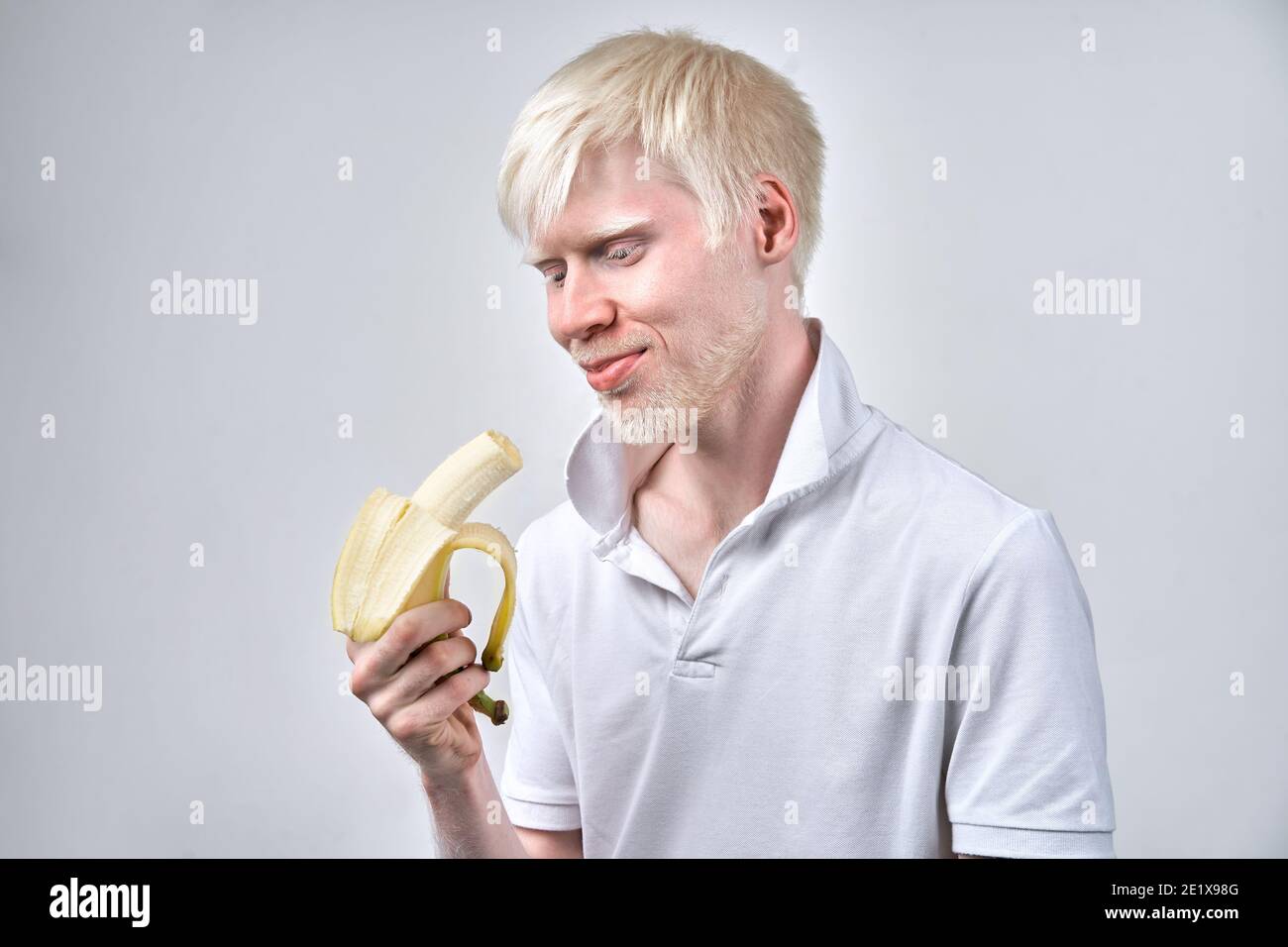 Albinisme albino homme peau blanche cheveux studio habillé t-shirt isolé fond blanc. Anomalies. Aspect inhabituel. Anomalie de la peau Beauti Banque D'Images