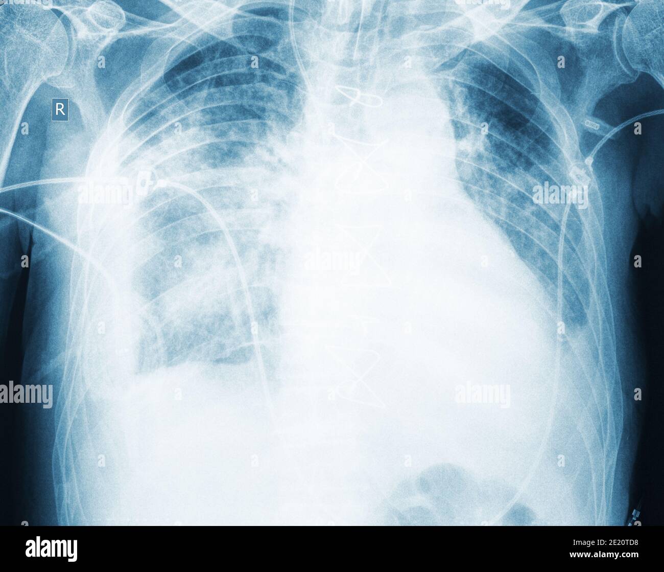 Image radiographique du patient, concept d'examen médical. Banque D'Images