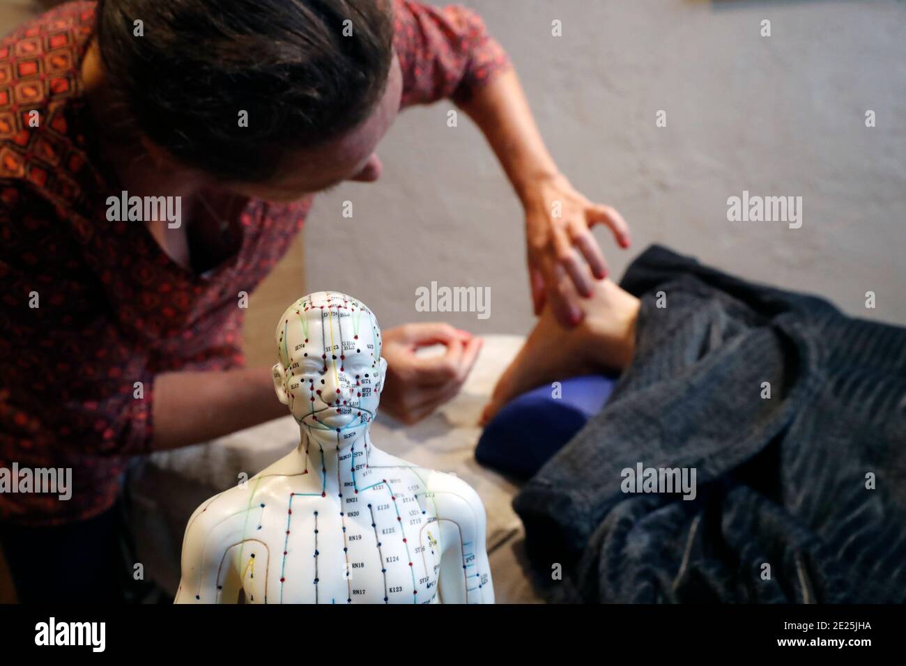 Medecine chinoise traditionnelle. Réglage précis d'une aiguille de ponction d'accppo dans le pied. France. Banque D'Images