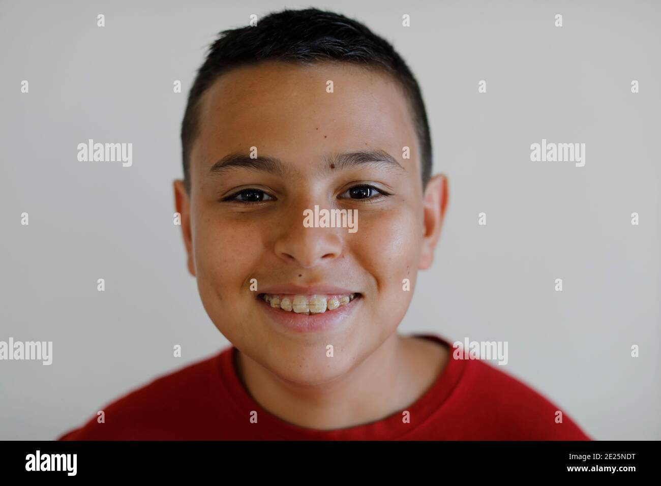 Garçon de 14 ans portant des bretelles à Montrouge, France Photo Stock -  Alamy
