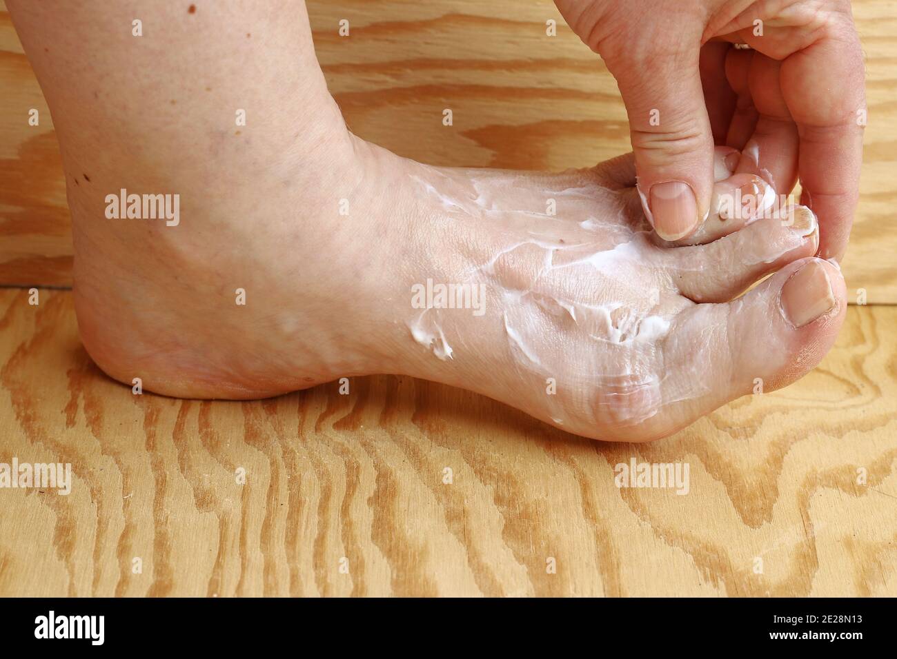 Une femme met de la crème sur son pied. Crème de pied contre la peau sèche et la cornée sur le pied. Crème contre le pied de l'athlète Banque D'Images