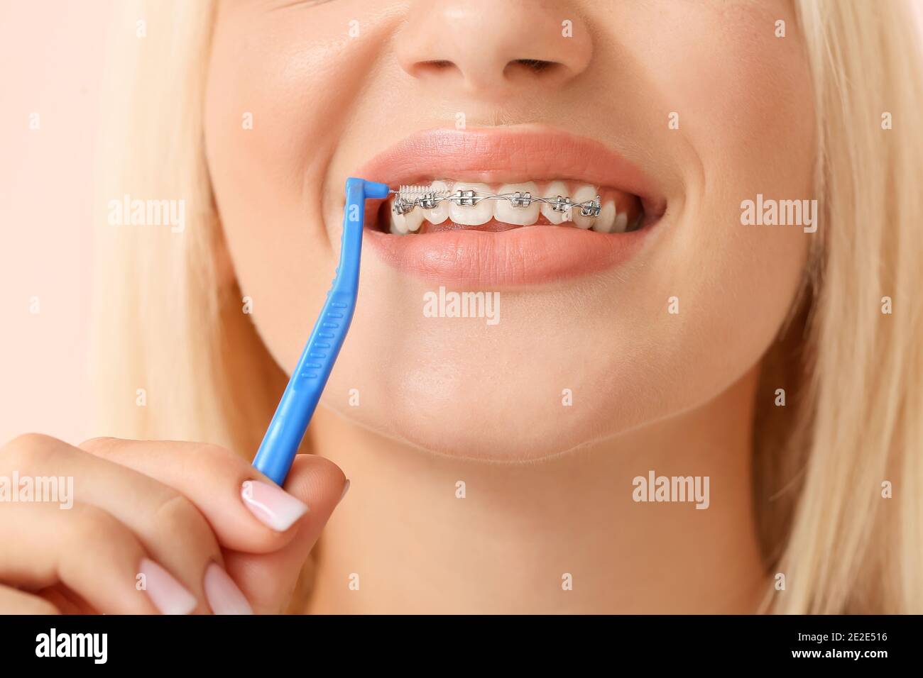 Jeune femme avec appareil dentaire et brosse à dents sur fond de couleur  Photo Stock - Alamy
