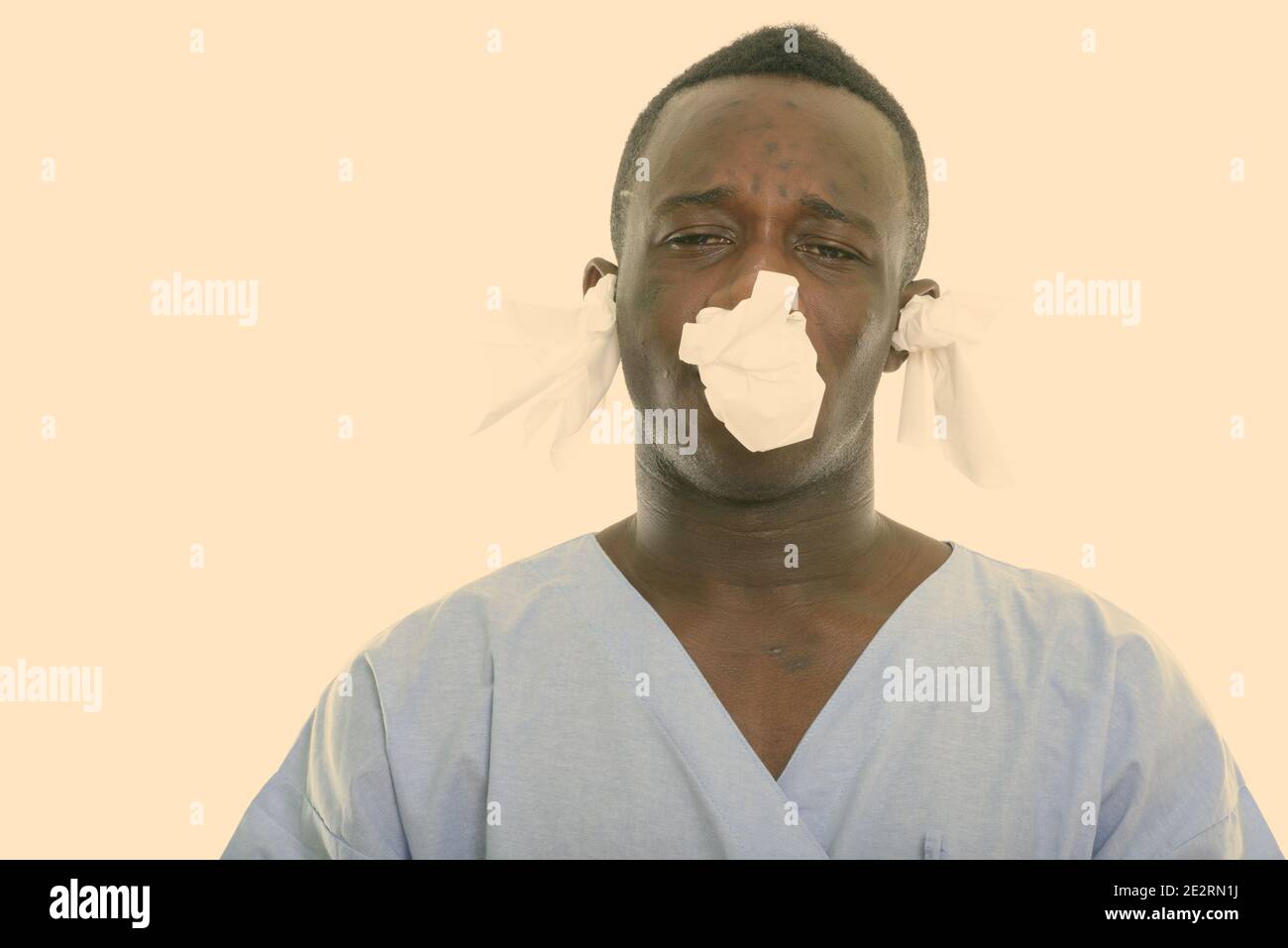 Portrait de jeune homme de l'Afrique noire à la recherche de patients malades avec des tissus dans les oreilles et le nez Banque D'Images
