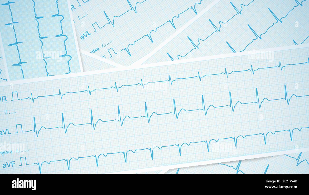 Les séquences de tracé ECG sont réparties sur la table sous forme de vecteur médical. Illustration de Vecteur